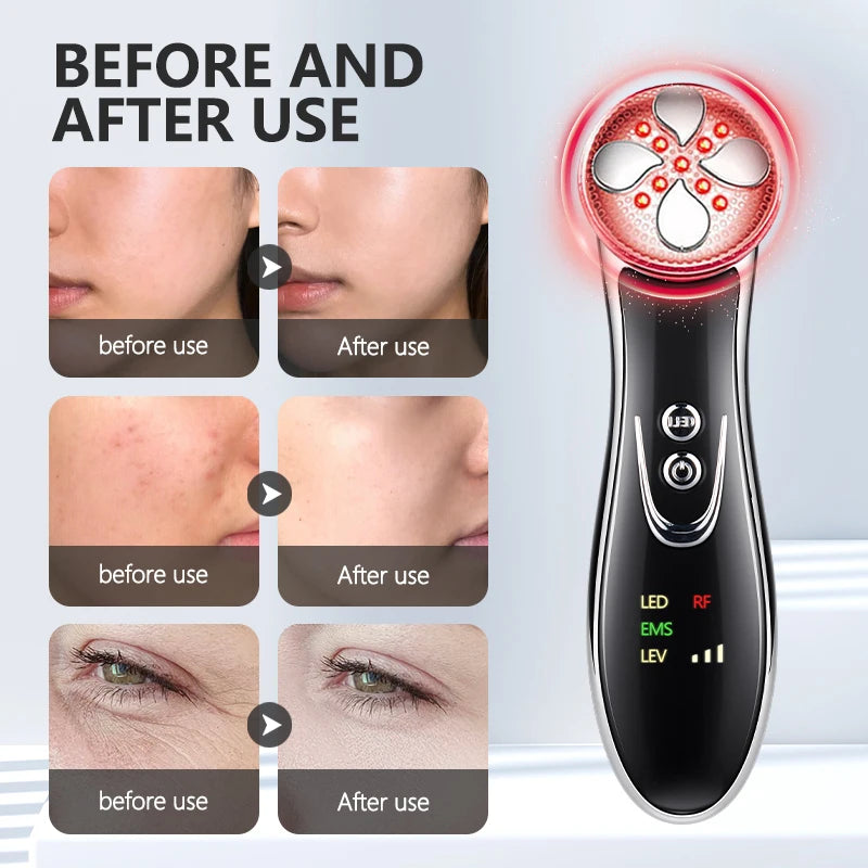 LED Skin Moisturizing Massage