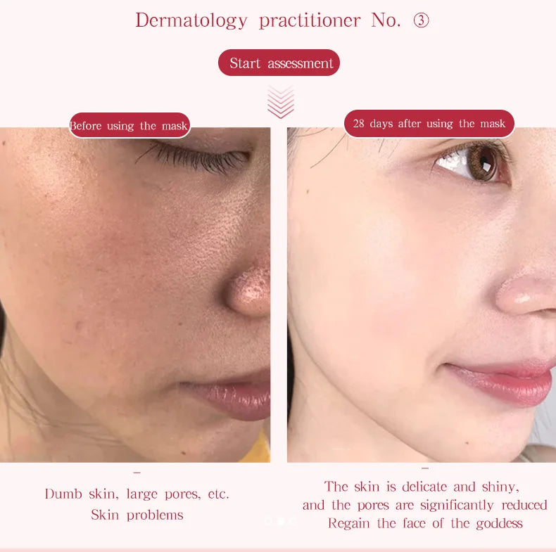 Led phototherapy facial skincare